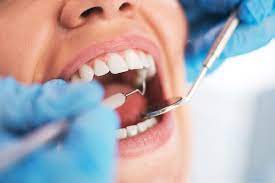 Transfert de charge des soins dentaires à l’AMC – Les adhérents pourraient « serrer les dents » dès l’an prochain